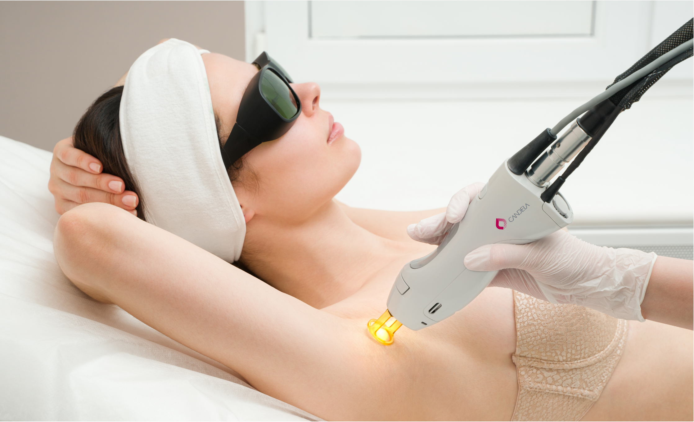 Laser Hair Removal in Kennesaw Decatur ChinUp Aesthetics