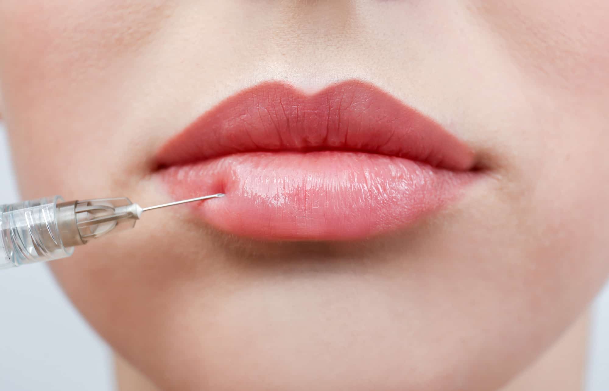 beautiful young woman receiving filler injection in lips, closeup
