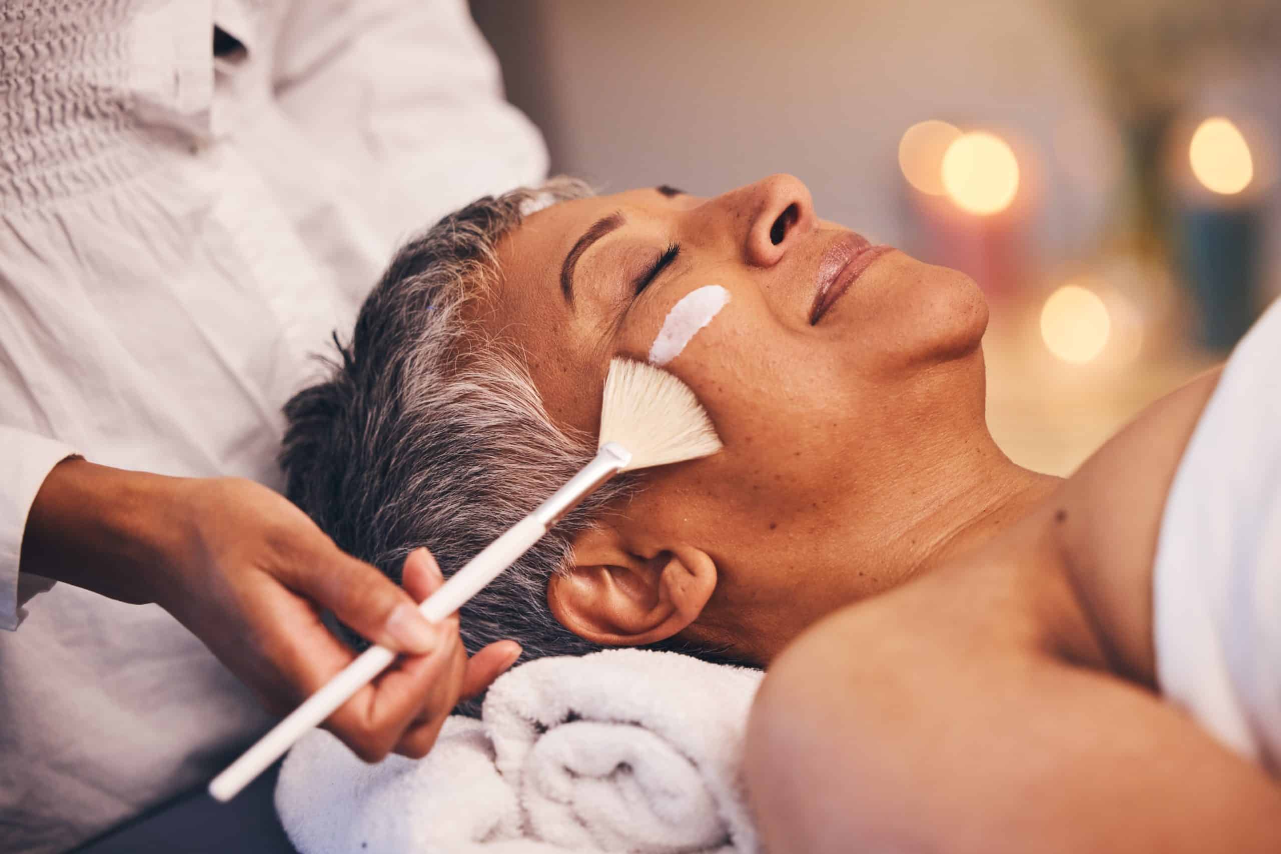 chemical peel at a med spa in atlanta, ga