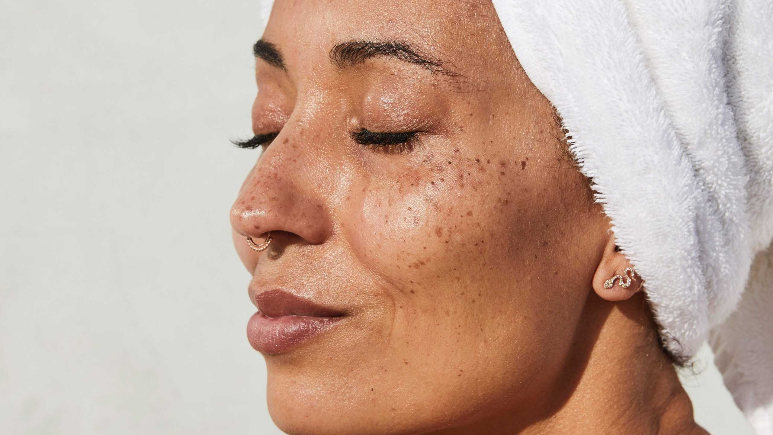 Woman with freckles and towel on head