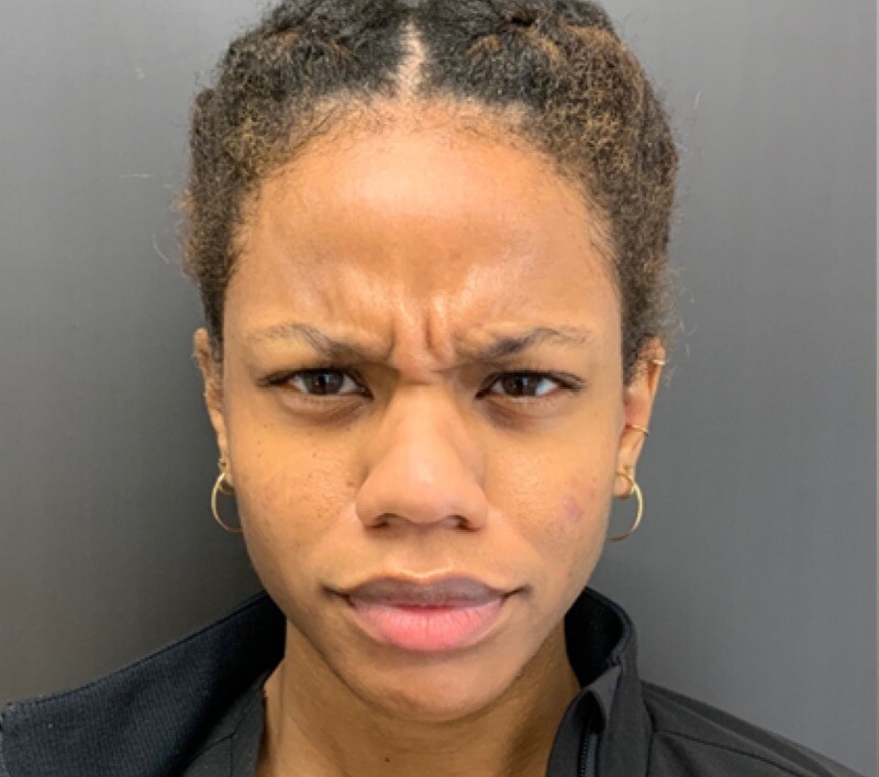 Dysport to address frown lines: before at Chin Up Aesthetics