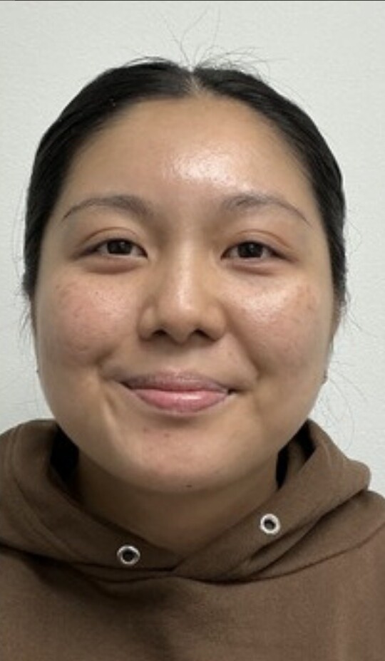 Microneedling: after at Chin Up Aesthetics