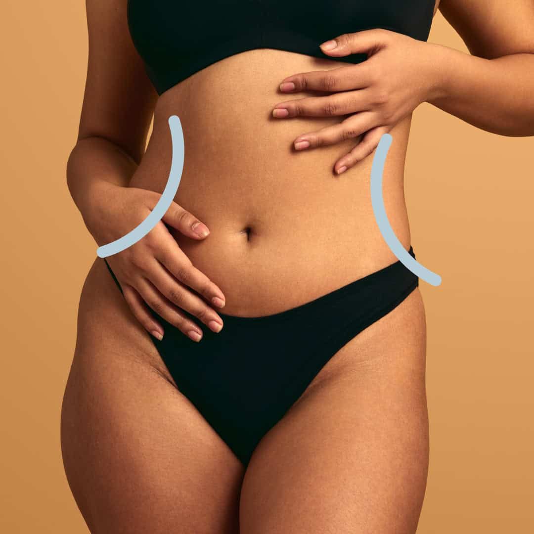 a person in black undergarments standing against a beige background with their hands on their waist and stomach. light blue curved lines are illustrated alongside the waist, likely highlighting the waist area. medspa near me