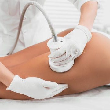 Skin Tightening Treatment